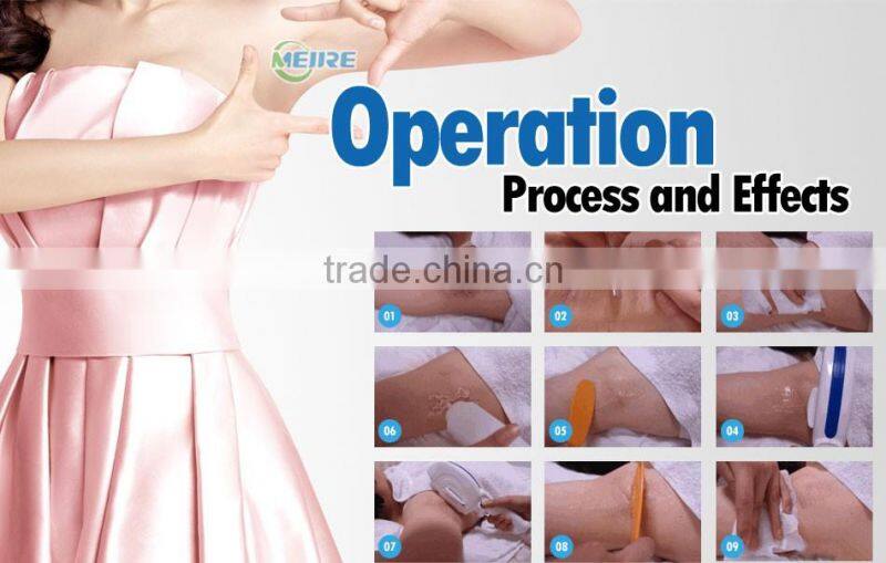 New design ipl shr opt laser permanent ipl laser removal