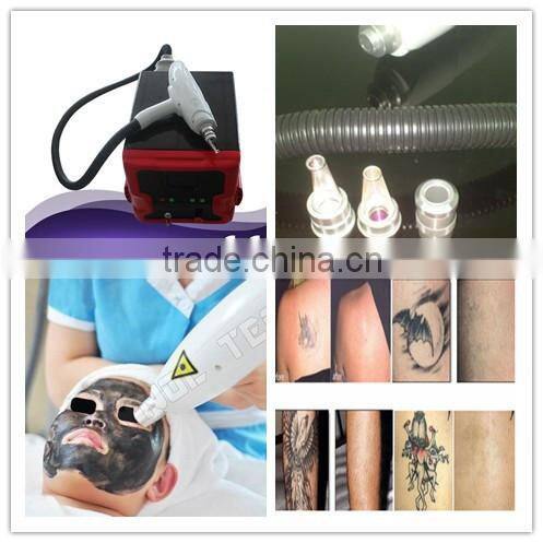 Portable Q Switch Nd YAG Laser/Nd:Yag Laser/Tattoo Machine