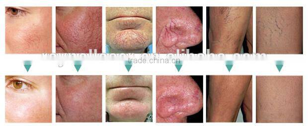 Portable high frequency galvanic facial machine