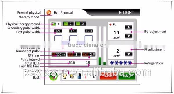 Hair removal and tattoo removal elight nd yag laser machine P-303