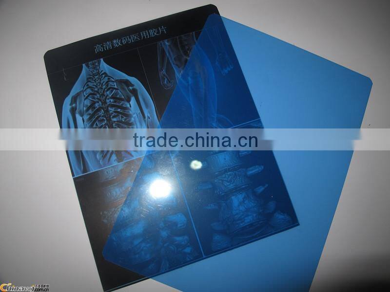 Agfa dry film/led light film/thermal imaging digital film dry film printer