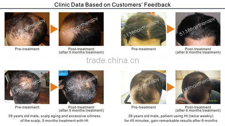 Three type scalp treatment Hair follicle stimulator (CE, Since1994)