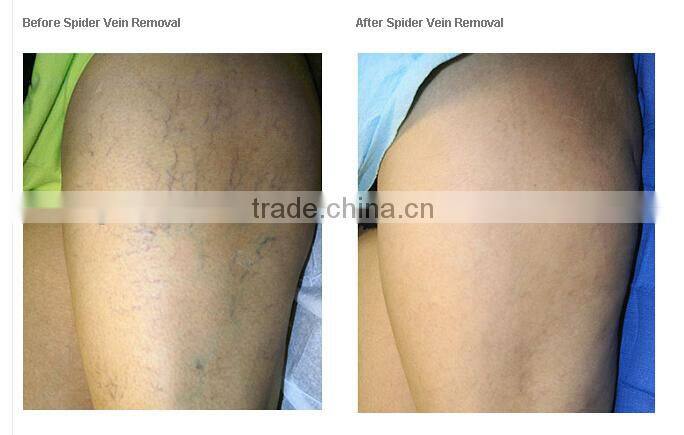 Mini IPL Skin Rejuvenation Machine/ Best Permanent Hair Removal IPL Beauty Device