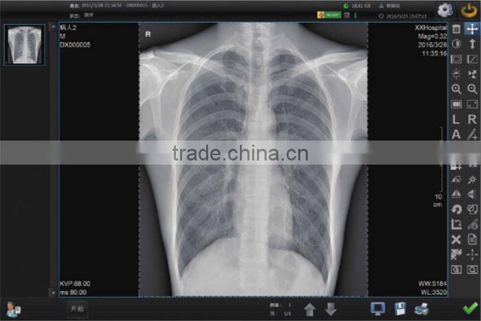 wired or wireless High resolution flat panel detector for sale