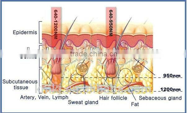 Factory price!!!hair removal laser machine prices/808nm diode laser hair removal machine with ROSH ,CE,ISO,SGS