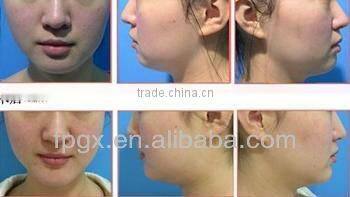 Professional skin rejuvenation IPL Beauty machine FP 2015