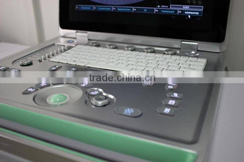 Hot Sale Full Digital Technology Ultrasound Scanner/ Echographe With Ce And Iso