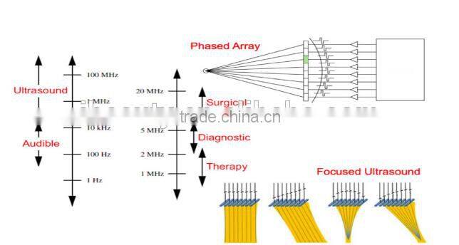 2015 Most Popular Lift Eyes&Brows Remove Crows Feet & Pouches High Intensity Focused Ultrasound Hifu