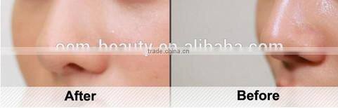 360 rotation Waterproof ultraSonic facial cleansing brush