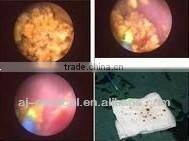 HOL-40W medical surgery instruments Holmium laser surgery equipment