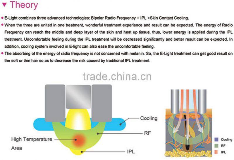 SHR Elight IPL Laser hair removal machine / CE approved cheapest SHR IPL E-light Machine