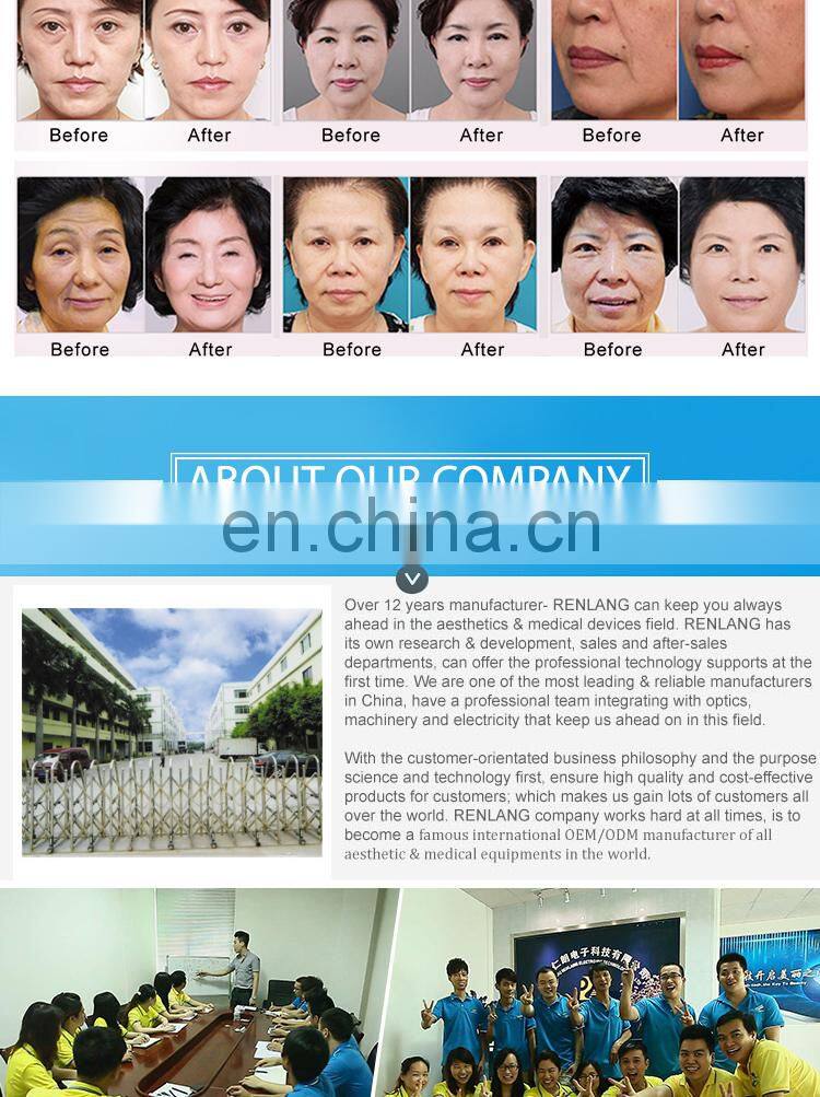 portable slimming machine rf skin tightening machine for sale