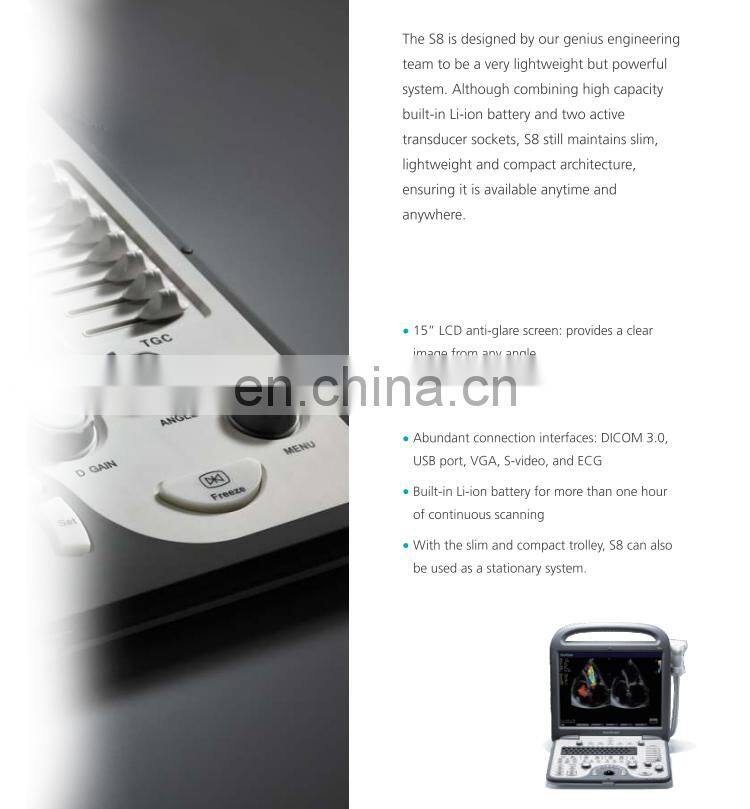Sonoscape S8 portable color doppler ultrasound scanner sonoscape ultrasound machine S8