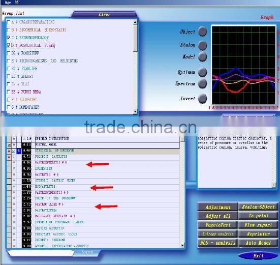 2014 Hi-tech Full Body Health Analyzer 3d NLS Phenitech