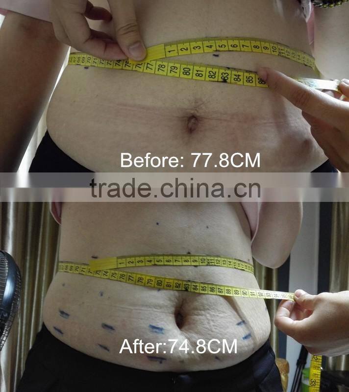 8MM and 13MM Portable Lipo HIFU System/ 1 session 1 smaller dress size