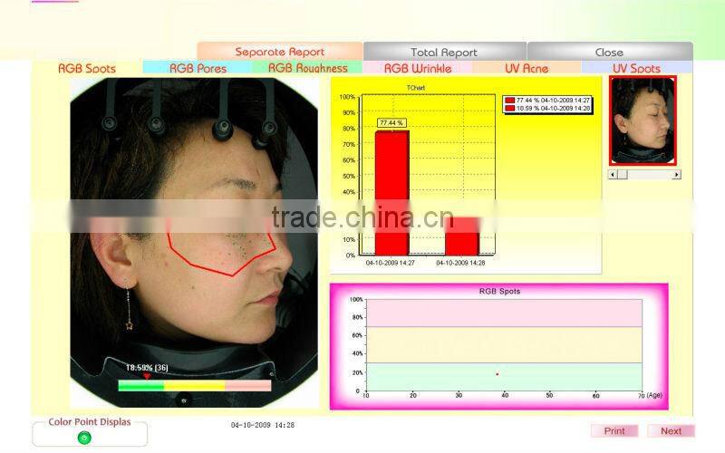 portable skin analyze machine/uv skin analyzer/skin analyzer