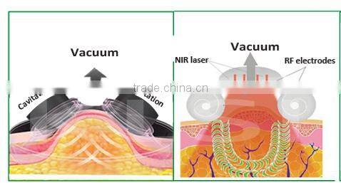 Laser RF Multi-functional 5 in 1 Multifunction Beauty Machine