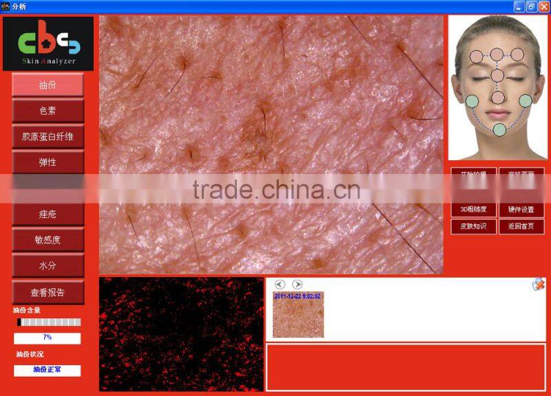 new products looking for distributor magic mirror skin scanner analyzer 5.0 MP High Resolution CCD USB skin scope