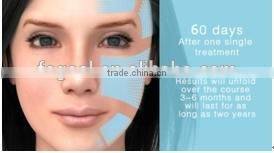 Beauty machine face lifting portable hifu / hifu for wrinkle removal system