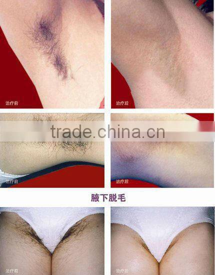 2015 newest portable IPL rf elight mini braun hair removal epilator shaver beauty skin care machine face body home sap salon