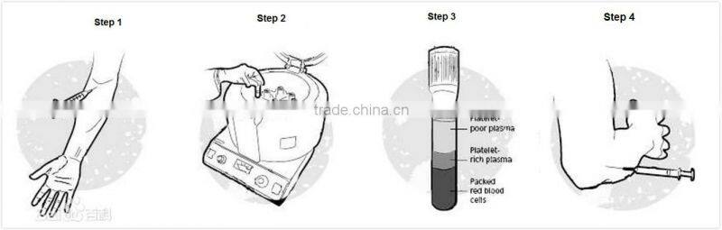 13*100mm steriled PRP tube used for skin treatment