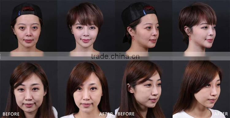 Popular HIFU wrinkle removal and skin tightening beauty equipment