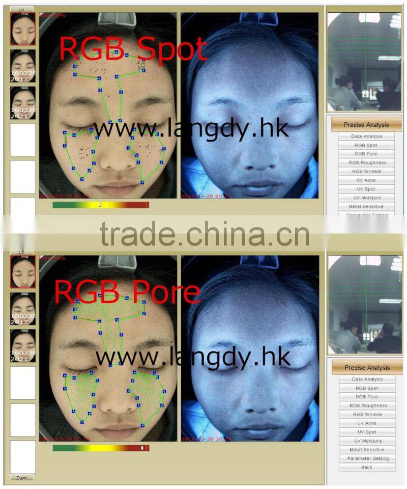 visia skin analysis portable machine with high pixel