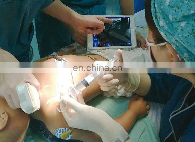 Sales 2022 factory price portable wireless ultrasound scanner ultrasound machine