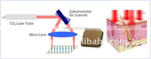 medical co2 fractional skin lifting acne removal tighten laser beauty machine