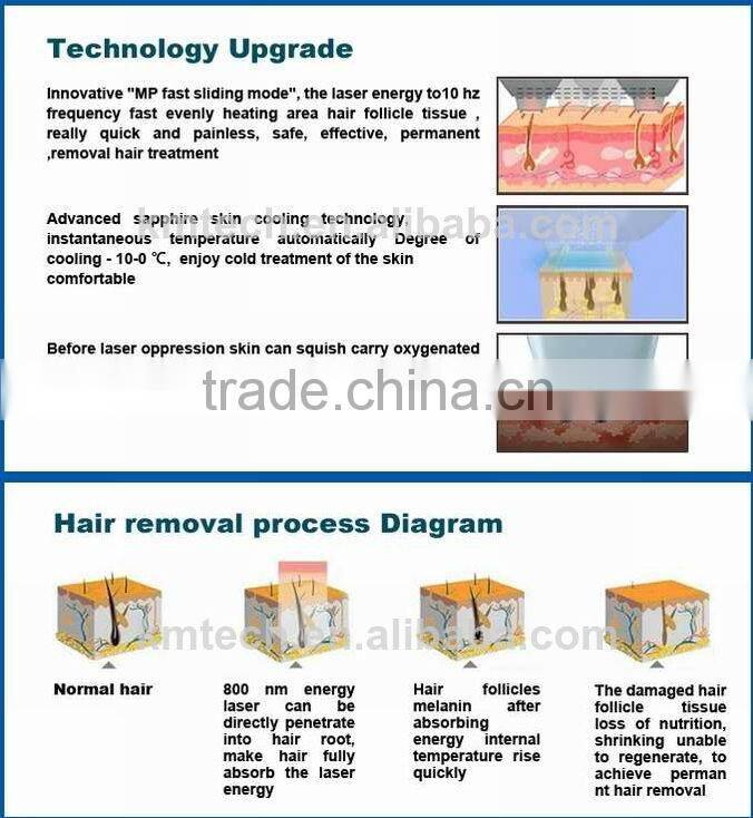 2016 Weifang KM factory! professional laser hair removal machine