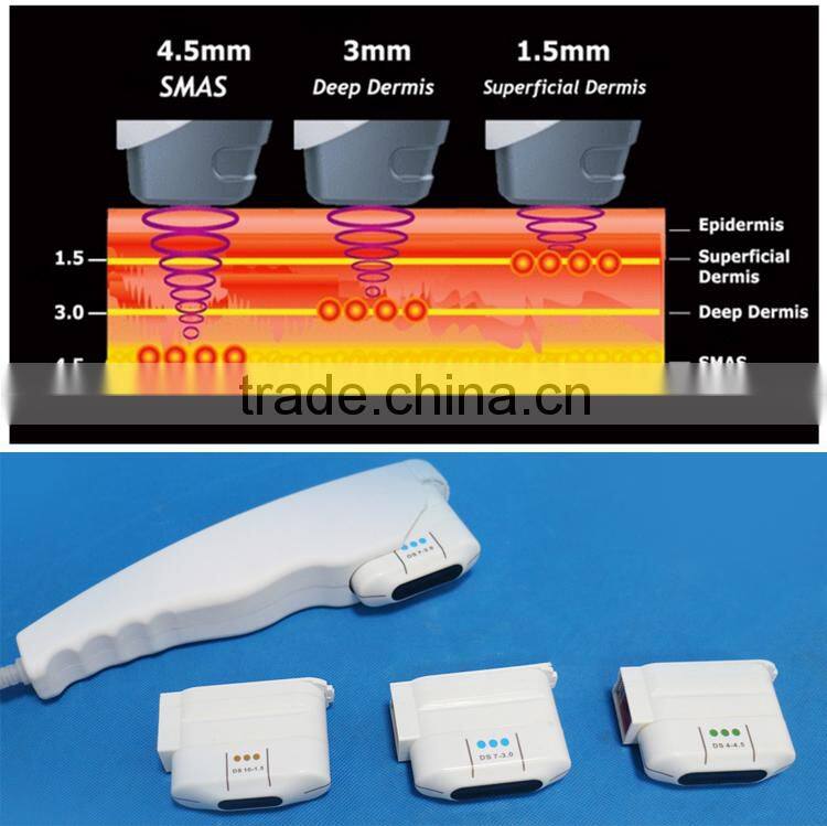 Hot sale neck treatments for sagging skin hifu system machine for anti aging anti wrinkle