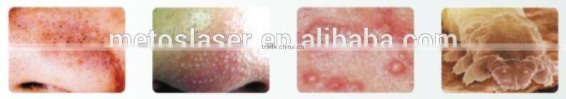 2016 Newest Multifunction Spa Facial Device