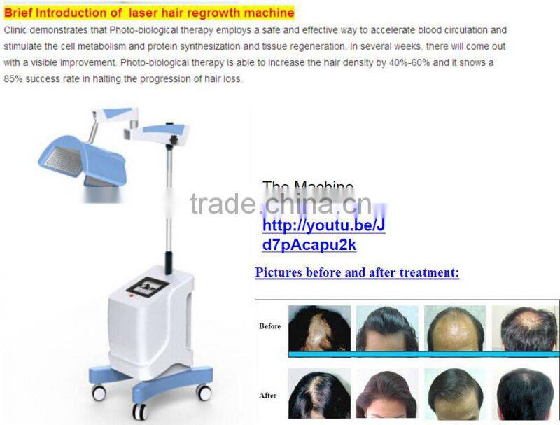 wholesale New Laser LED hair loss treatment hair regrowth / olaplex