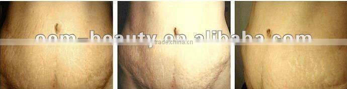 2012 best lady hair remover epilator small ipl beauty equipment for beauty salons-CE