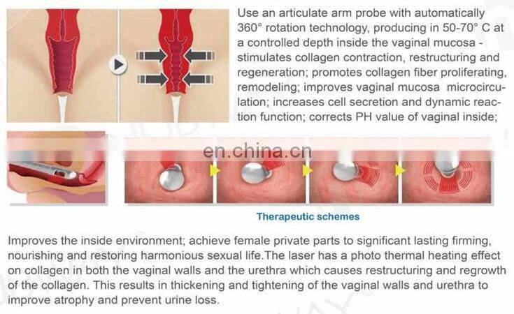 Technology advanced co2 fractional laser skin resurfacing fractional co2 laser machine
