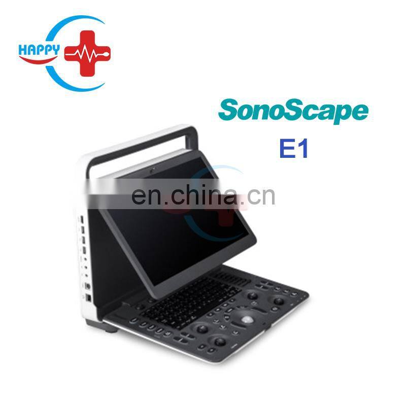 SonoScape E1 Portable Color doppler Ultrasound with 3 probe connector/SonoScape E1 EXP