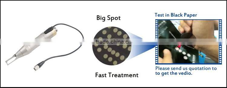 PicoSecond laser new laser for tattoo removal pigment removal