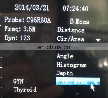 HC-A003 Cheap Full digital laptop veterinary ultrasound scanner machine