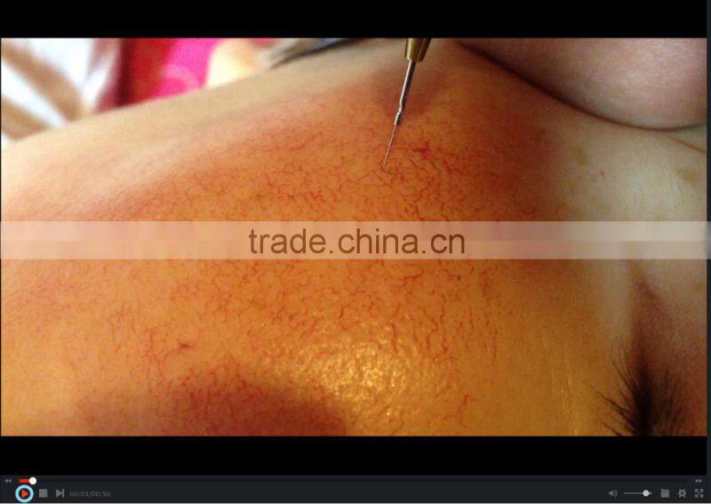 2016 Special promotion !!! High frequency thermocoagulation spider vein removal machine