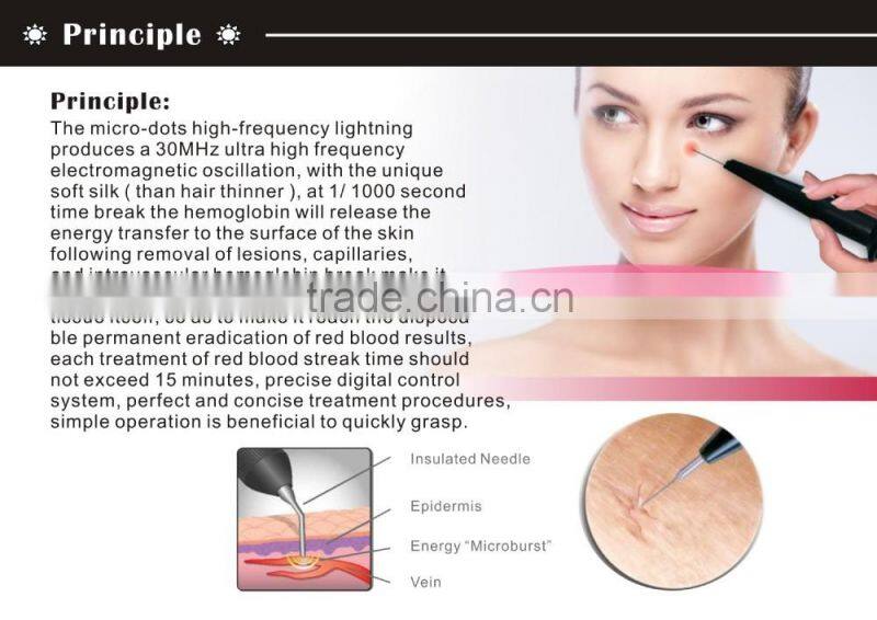 mini Blood Vessels Removal Spider Vein Removal Vascular Removal machine