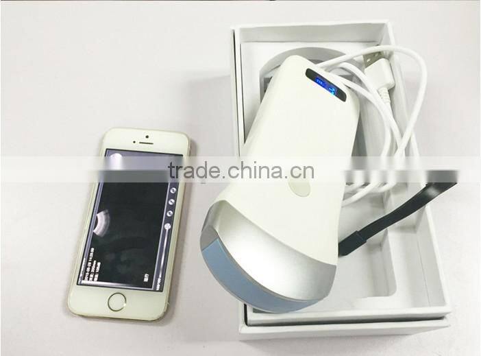 Wireless Convex Probe Scanner, WiFi, Used in Surgery Without Fixing of Cables, 3.5MHz / R40 / 64 Elements, SIFULTRAS-5.1