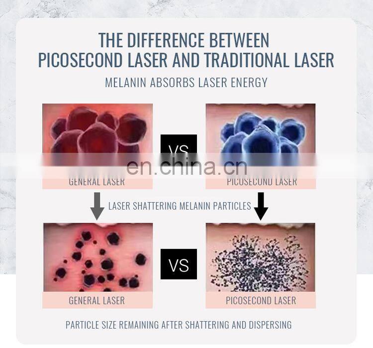 Portable Q-Switched 755 Pico Tattoo Removal Skin Rejuvenation Beauty Machine For Salon Use