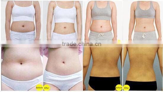 high intensity focused ultrasound body machine for sale