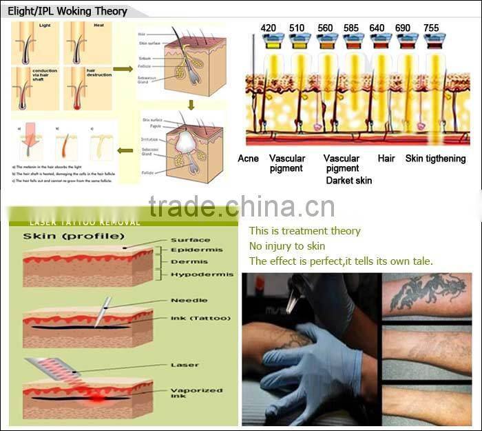 Hot selling CE TUV approved ml 2 in 1 elight+laser yb5