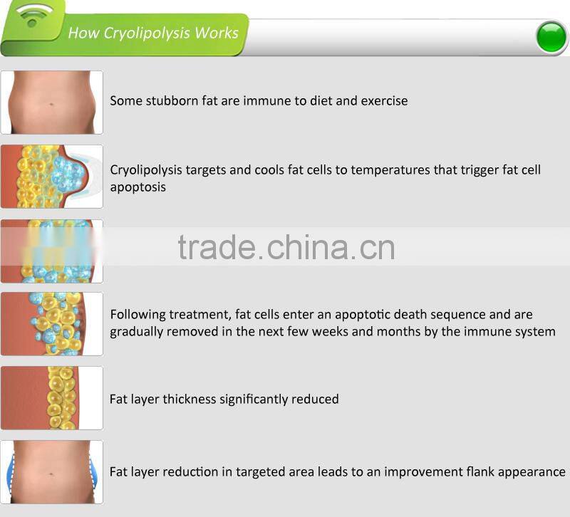 New Product Fat Freezing Machine / Multifunction Cryolipolysis Machine