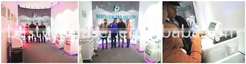 2017 Top high power 670 nm laser diode treatment hair loss BM-666