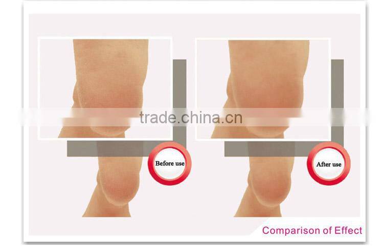 Pedicure File Feet Callus Removal Tool