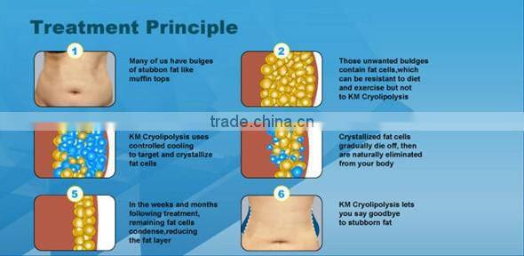 Hot promotion!!!!!2014 Newest Beauty Equipment Cryolipolysis Fat Reducing Machine