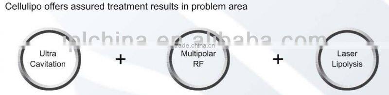 Slimming system ultrasonic liposuction cavitation rf machine- Cellulipo