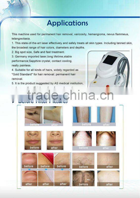 808 Diode Laser Hair Removal Machine beauty personal care